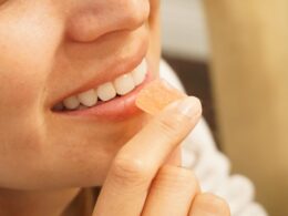 Teeth Whitening