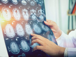 Radiographer vs Radiologist